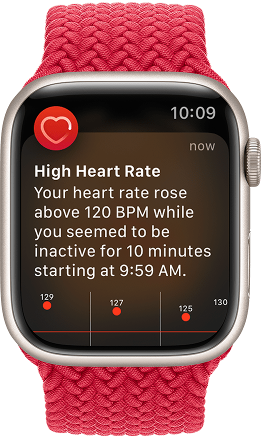 Apple Watch Irregular Heart Rhythm